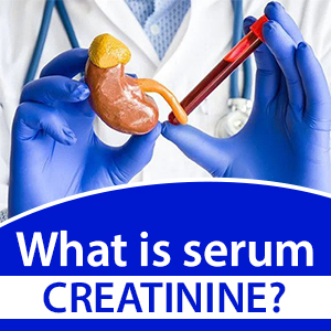 What is serum creatinine?