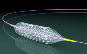 United States Renal Artery Stent Market 2017 - Cordis Corporation, C.R. Bard