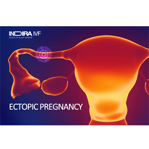 Ectopic Pregnancy- Causes, Treatment and Symptoms