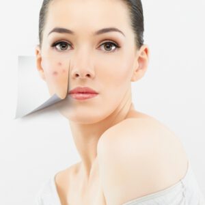 4 Questions to Ask Before You Go for Microdermabrasion