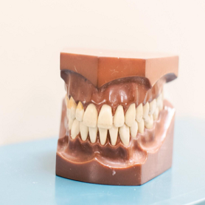 What are the Primary Causes of Tooth Decay?