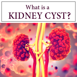 What is a kidney cyst?