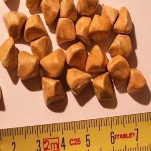 Different Types Of Kidney Stones Treatment You Should Know