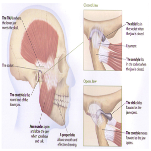 Diagnosis and Treatments of TMJ