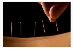 Best Acupuncture Los Angeles – Raah Acupunctur
