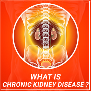 What is chronic kidney disease?