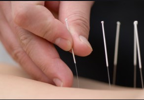How Does Acupuncture Work?